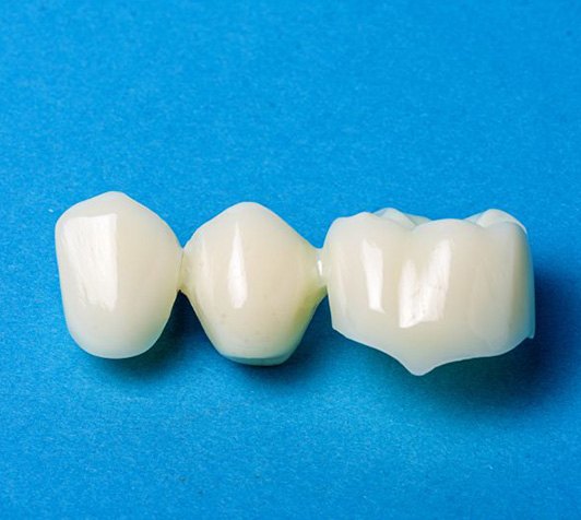 Three-unit dental bridge against blue background