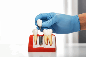 Dentist lifting a crown from a dental implant model 